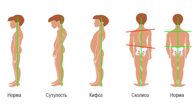 Остеопатия для детей
