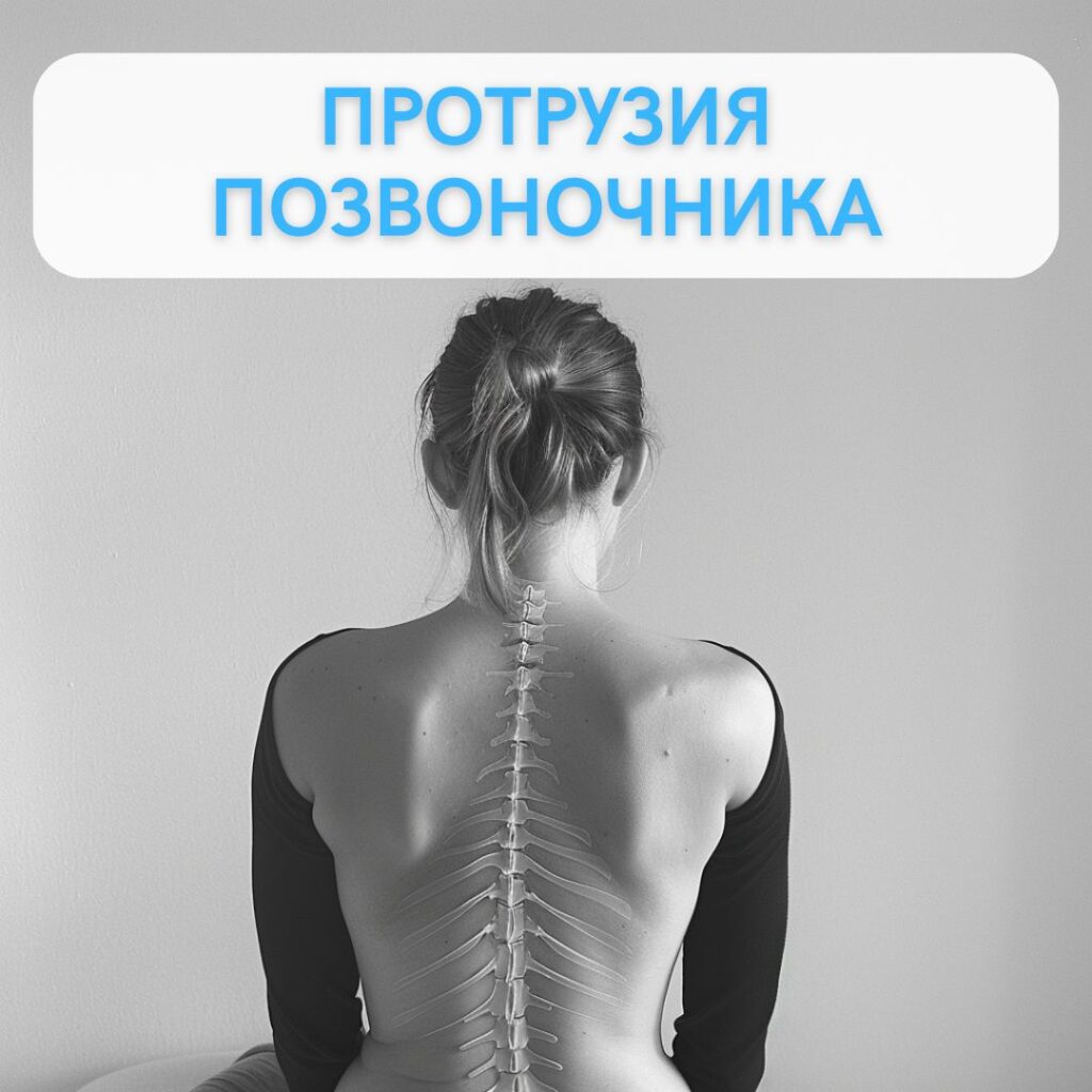 Протрузия позвоночника: симптомы, лечение и профессиональная помощь от остеопата