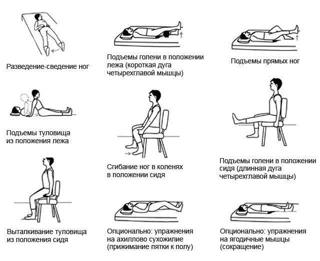 артроз лечение