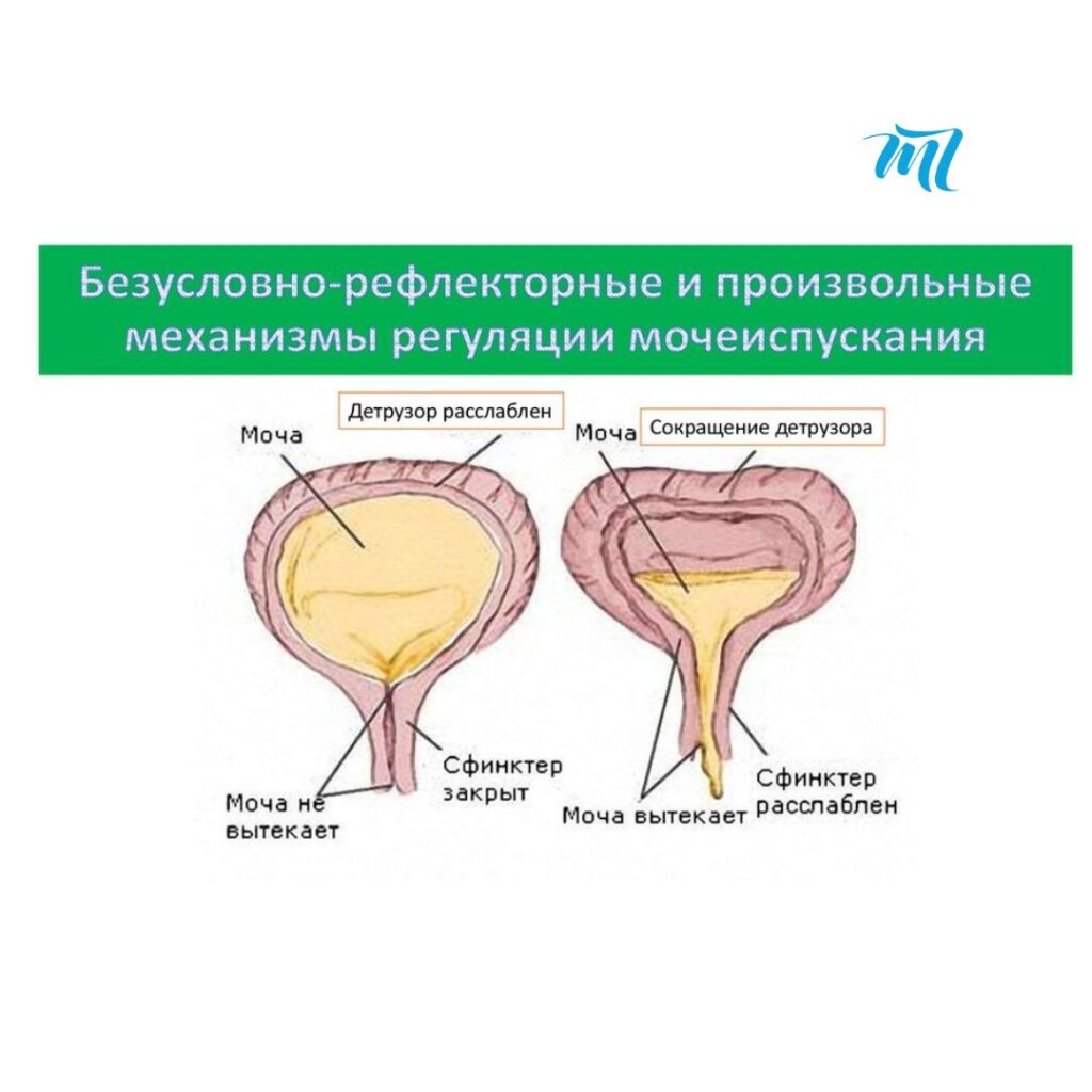 энурез психосоматика