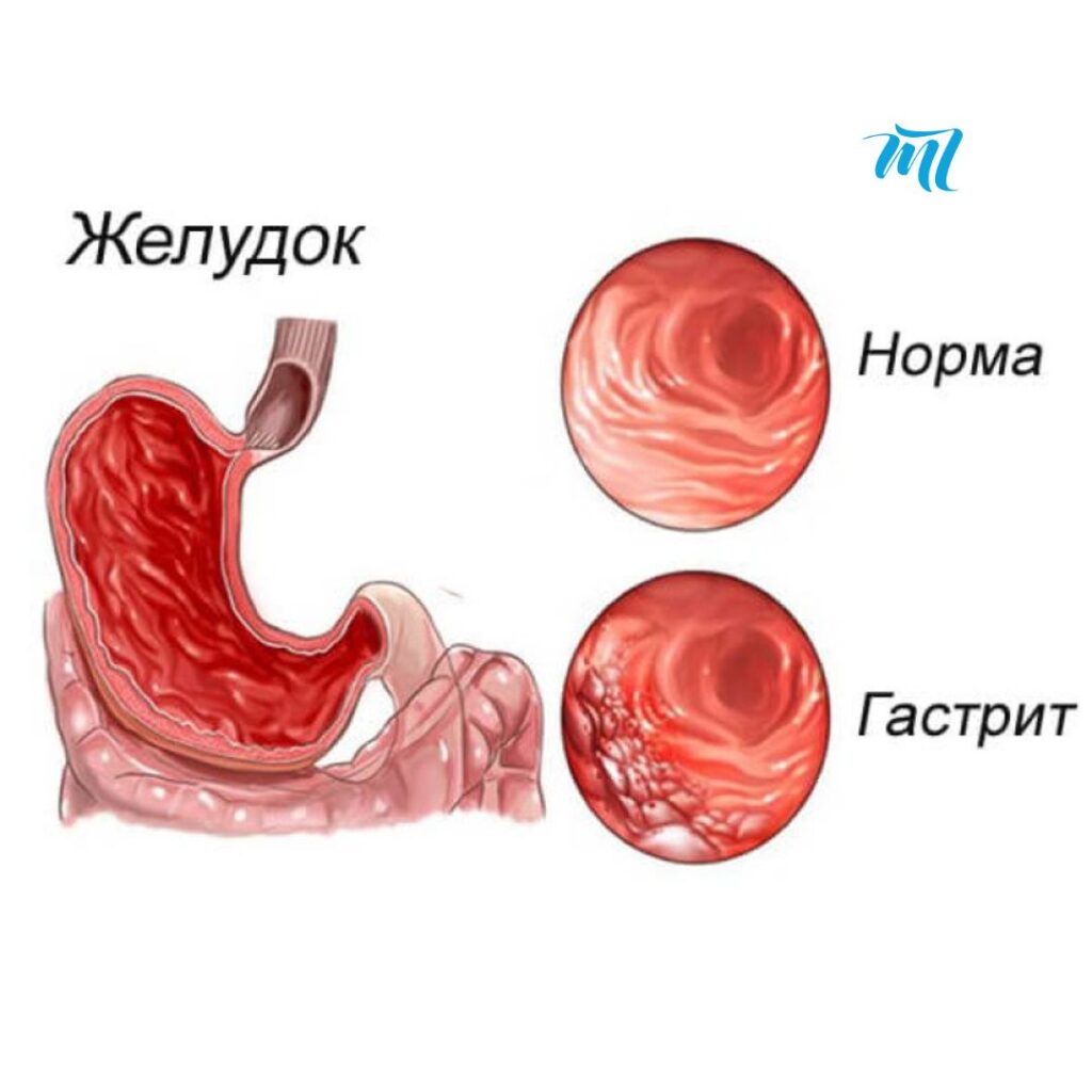 болить шлунок психосоматика