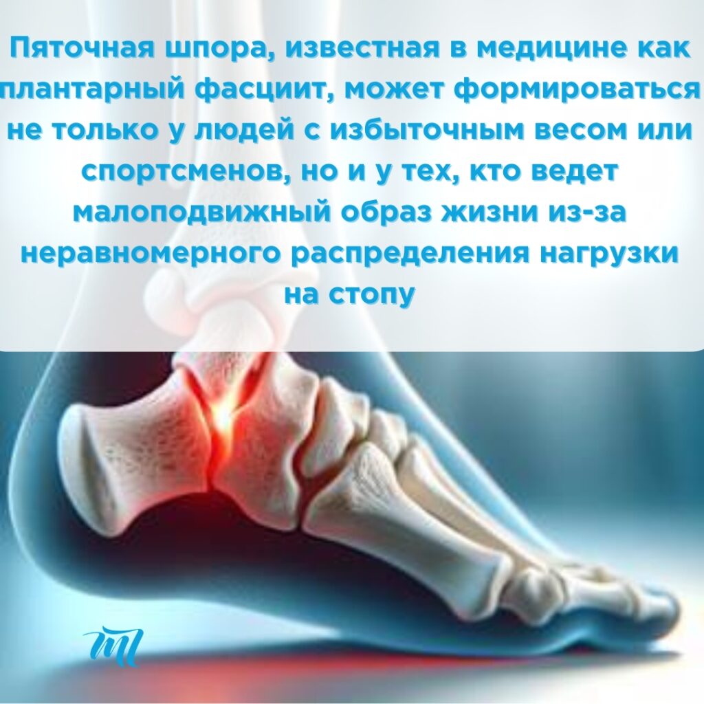 шпоры на ноге