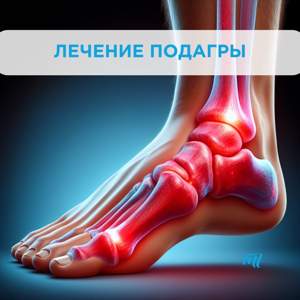 Подагра: причины, симптомы и методы лечения