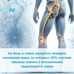 Защемление нерва в пояснице
