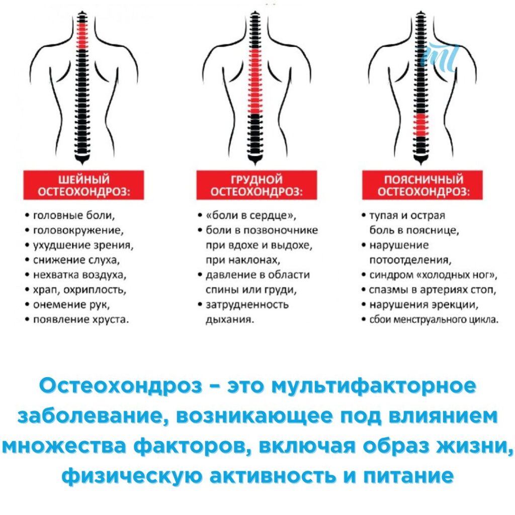 Лечение остеохондроза в Киеве