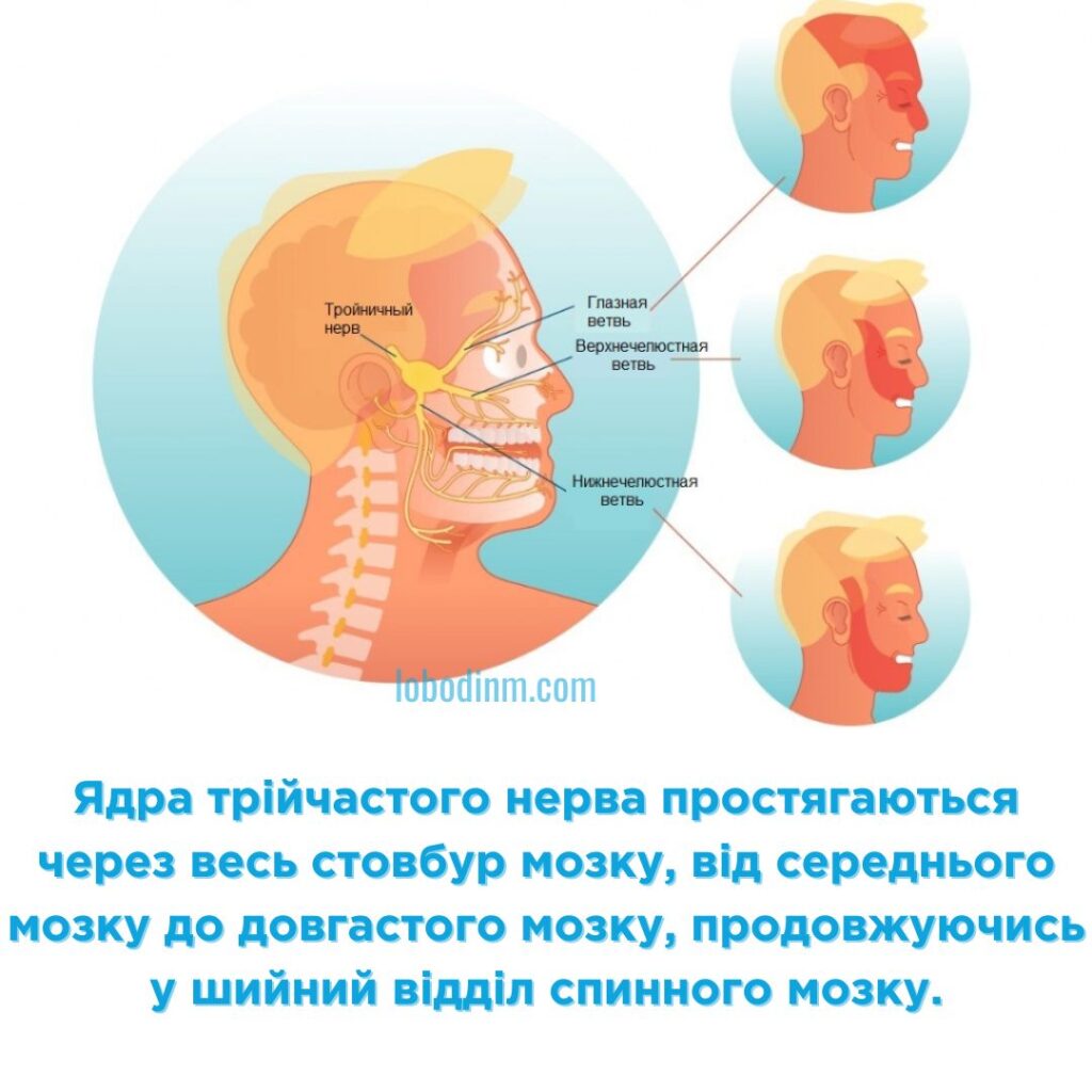 Невралгія трійчастого нерва