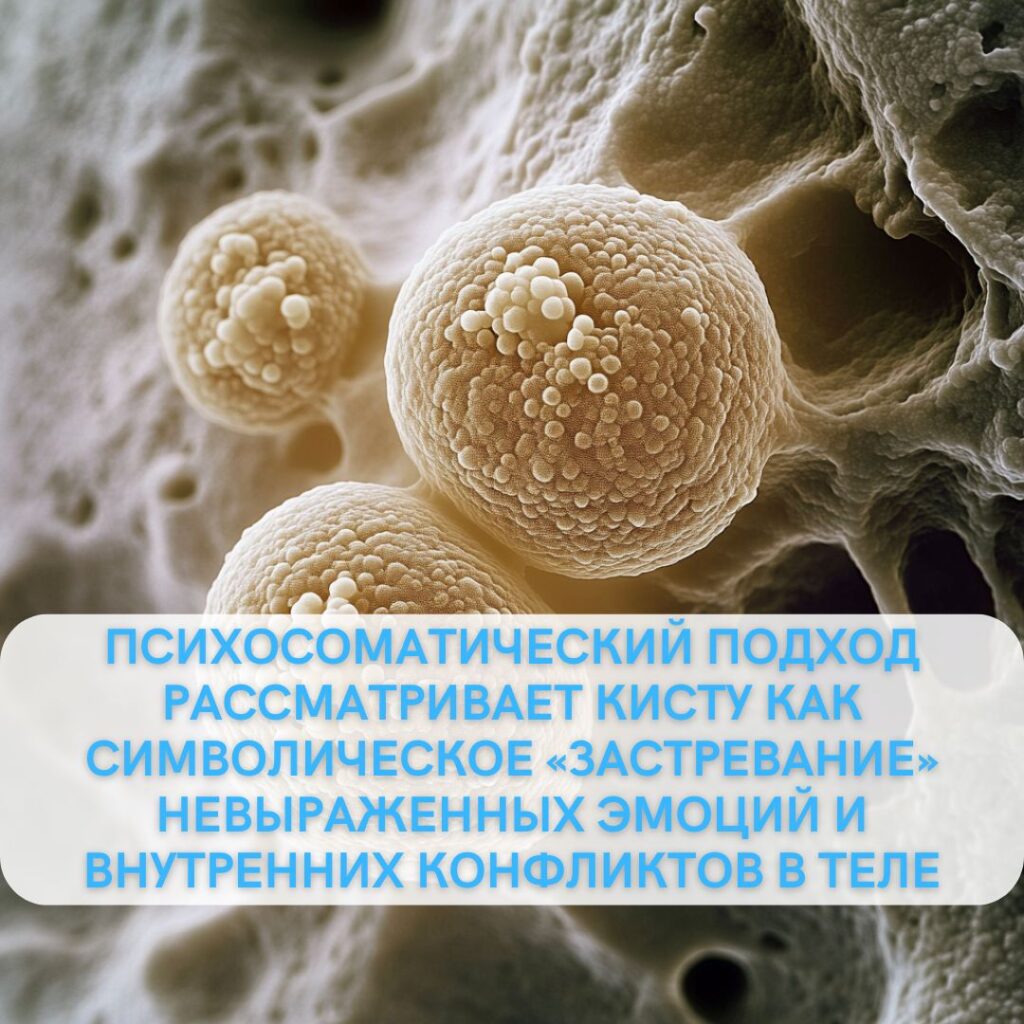 Психосоматика кисты яичника